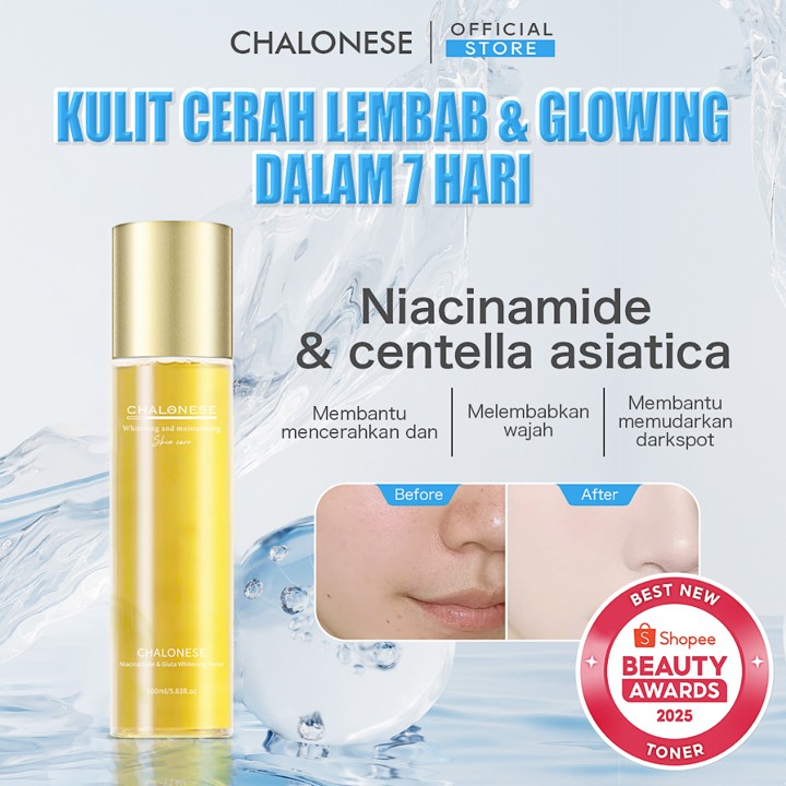 [CHALONESE] GLUTA WHITENING TONER 160ML Mampu Mengangkat Sel Kulit Mati di Wajah BPOM Cocok Semua Jenis Bikin Kulit Fresh Lembap & Glowing Kulit, Anti Kusam