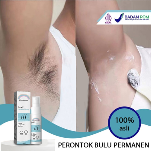 Perontok bulu permanen penghilang bulu ketiak semprotan penghilang rambut peront